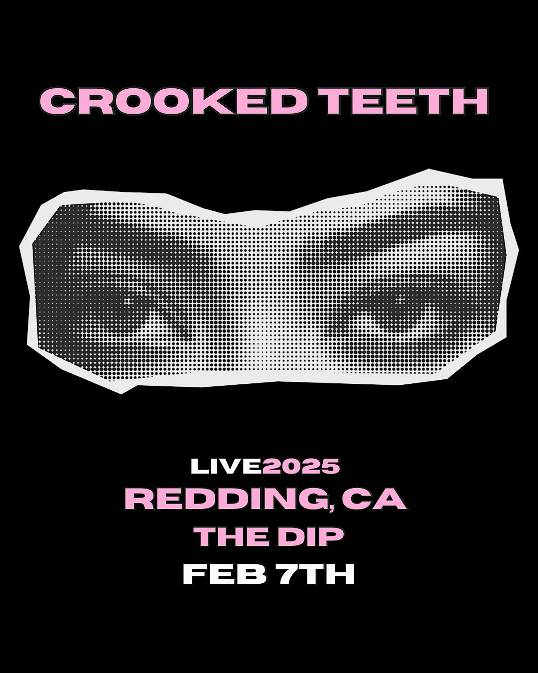 Crooked Teeth – Redding, CA