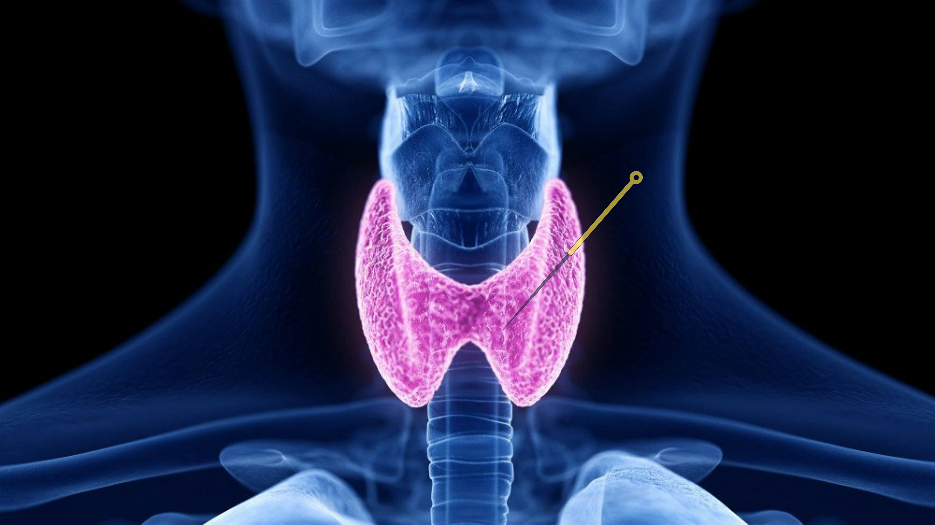 CEU – Acupuncture and Herbal Medicine Approaches to Thyroid Dysfunction at 2550 Shattuck Ave. – Berkeley, CA